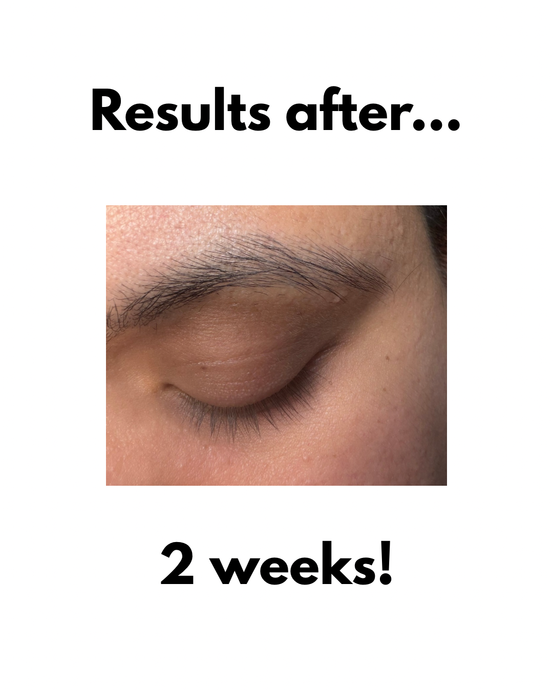 The Lash Growth Potion
